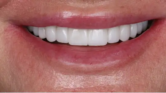 Case 01, after treatment
