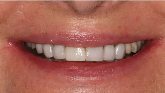 Case 01, before treatment
