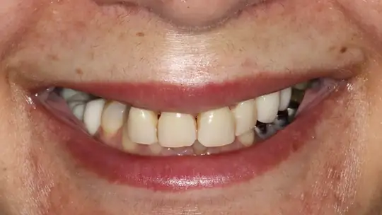 Case 02, before treatment
