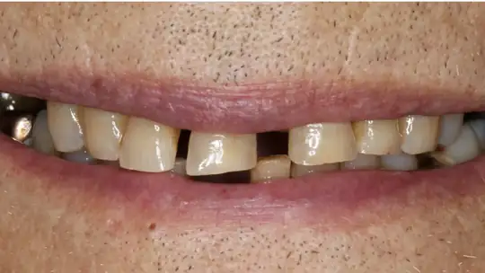 Case 03, before treatment