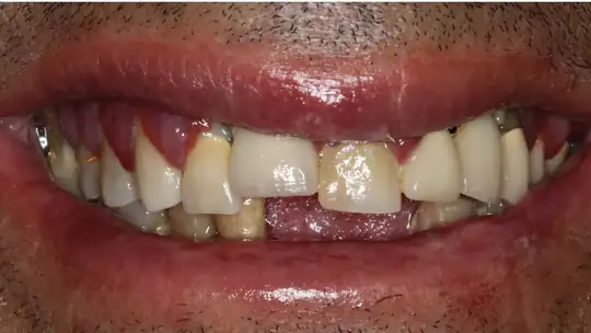 Case 05, before treatment