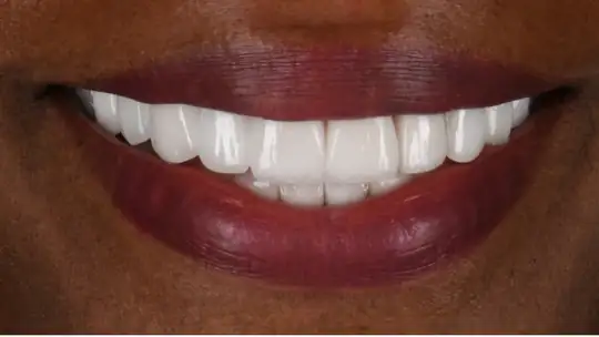 Case 06, after treatment