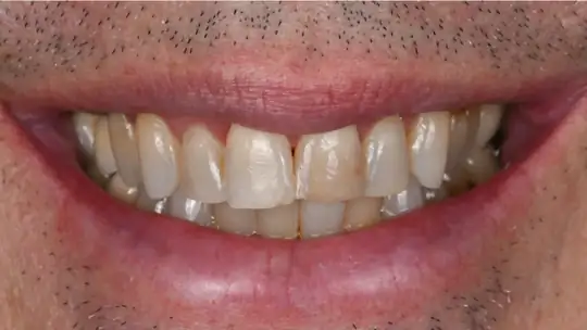 Case 07, before treatment