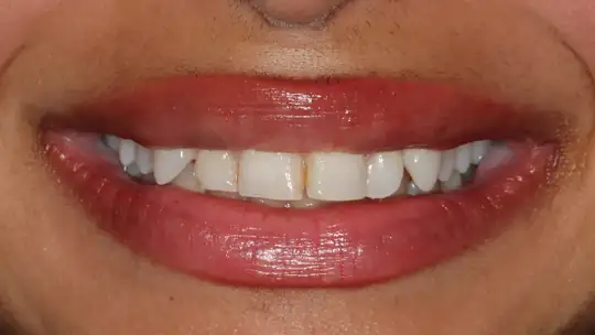 Case 08, before treatment
