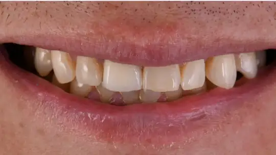 Case 09, before treatment