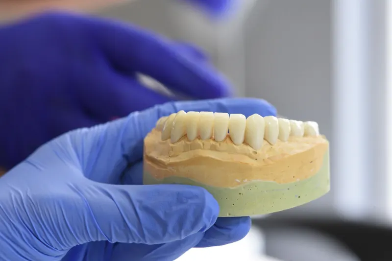 Gloved hands holding a full arch dental model