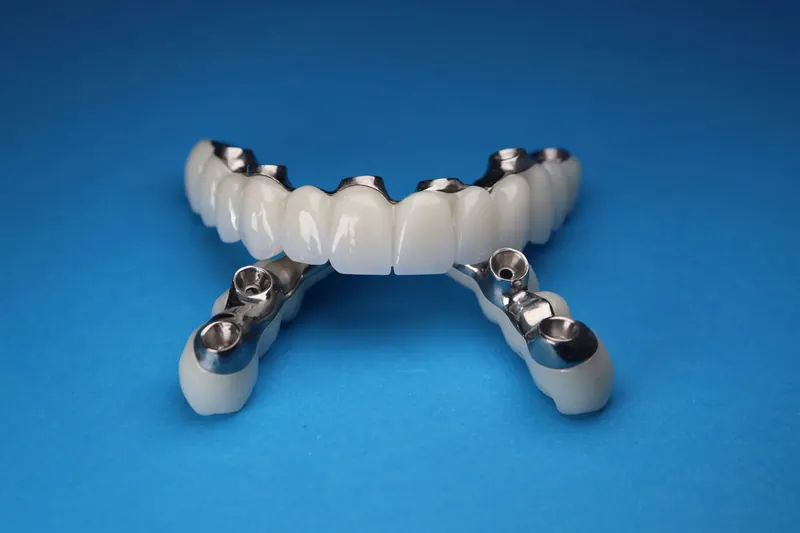 A full arch implant bridge with its titanium connectors, shown on a blue background
