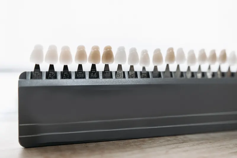 A porcelain shade guide used to match the color of veneers to the surrounding teeth