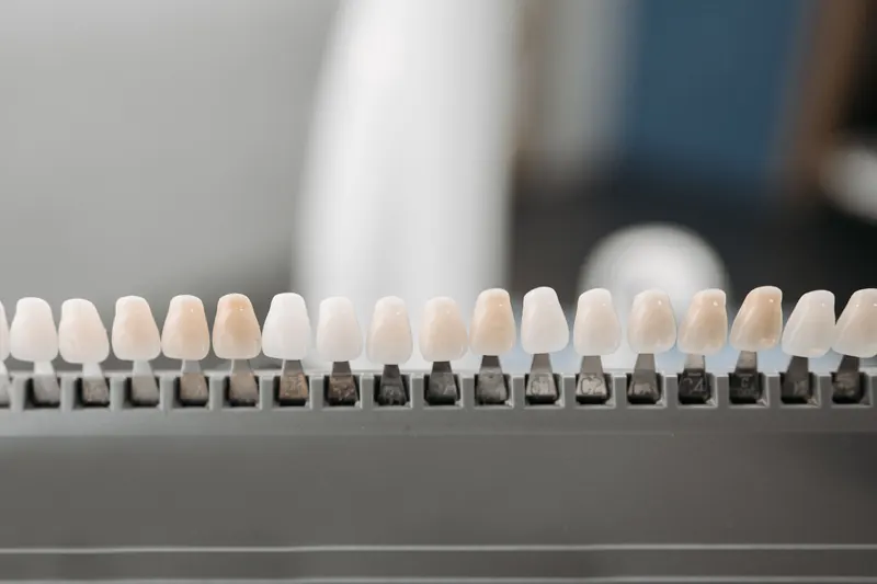 Porcelain veneer samples lined up on a display rack in a range of shades