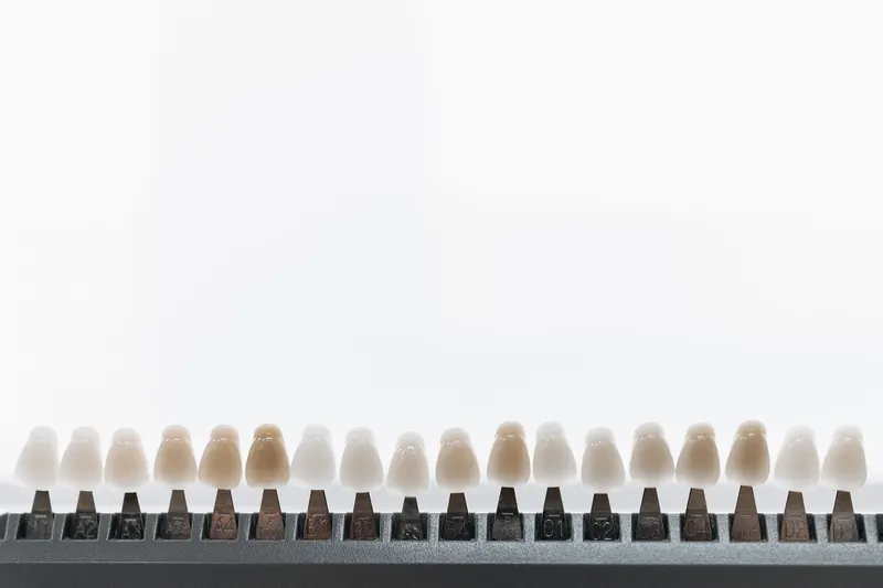 A row of porcelain veneer shade samples, from bright white to warmer natural tones