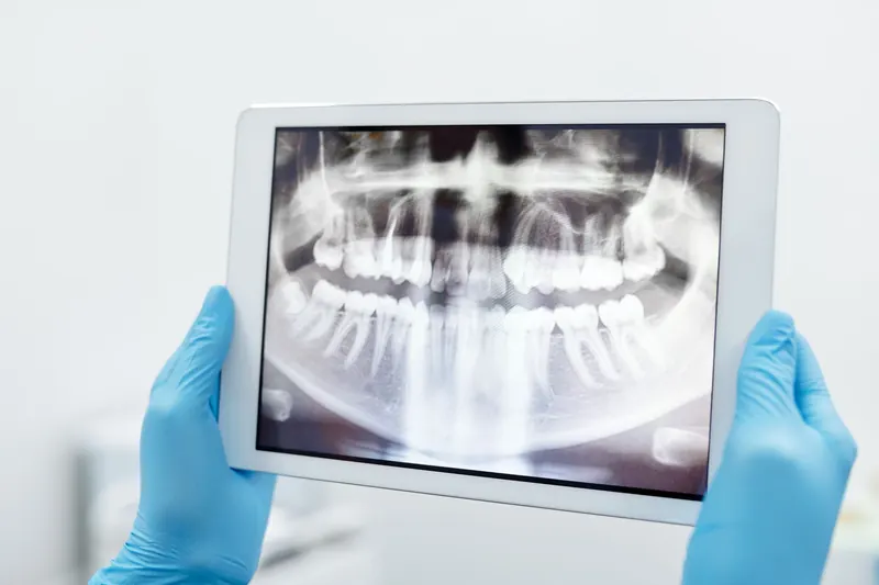 Gloved hands holding a tablet that shows a panoramic dental X-ray